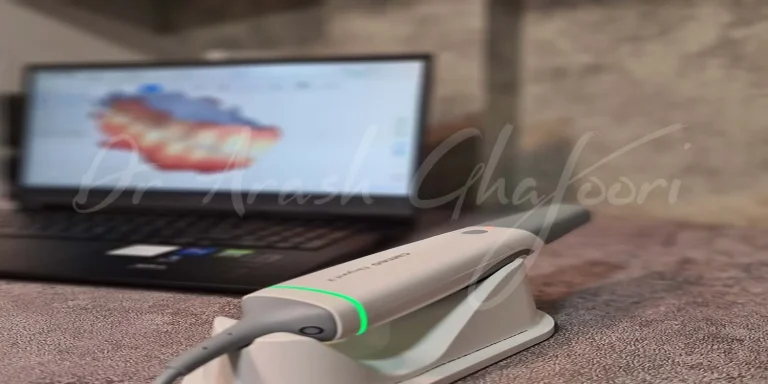 بهترین مرکز ایمپلنت دیجیتال در رشت
