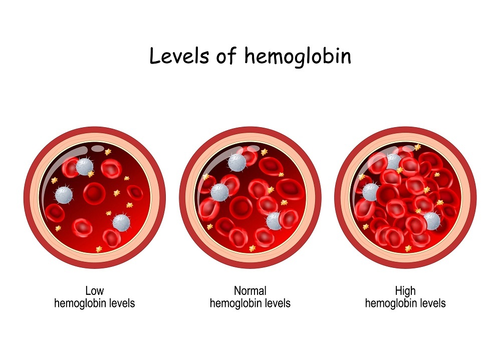 What are the side effects of high blood hemoglobin