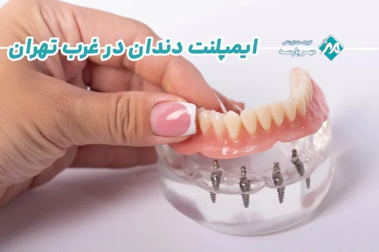 بهترین متخصص ایمپلنت دندان در غرب تهران